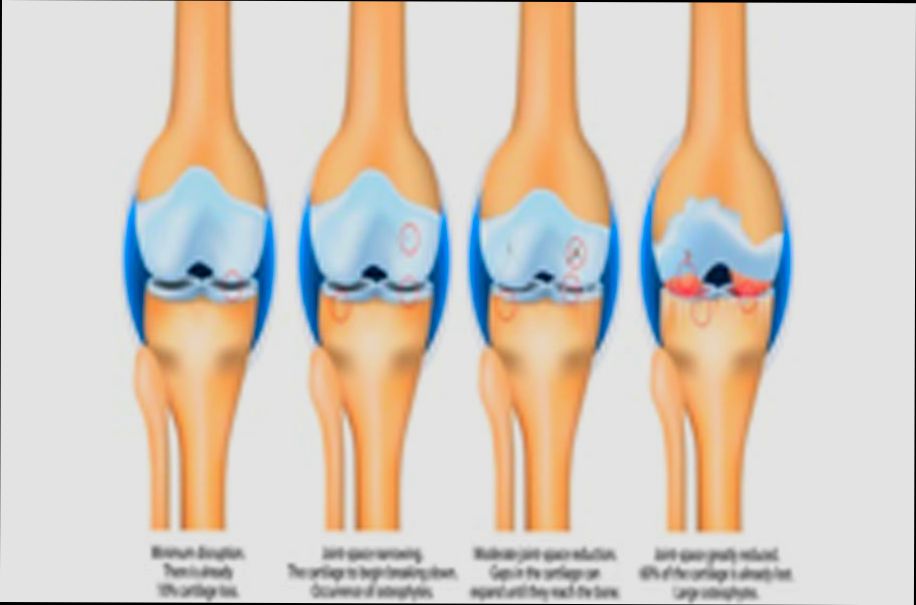 What is DJD Tax and When to Pay It - 3